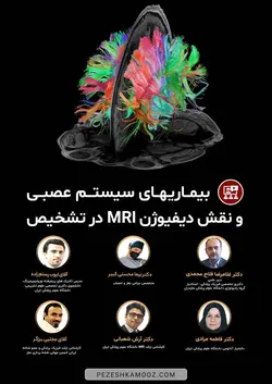 بیماری های سیستم عصبی و نقش دیفیوژن MRI در تشخیص