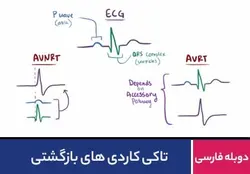 تاکی کاردی های بازگشتی