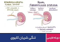 تنگی شریان کلیوی