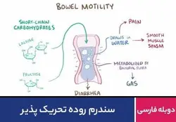 سندرم روده تحریک پذیر