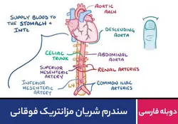 سندرم شریان مزانتریک فوقانی