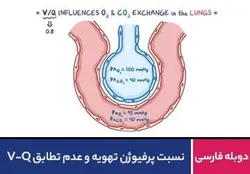 نسبت پرفیوژن تهویه و عدم تطابق V-Q