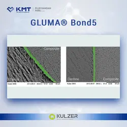 گلوما باند5 کولزر GLUMA® Bond5