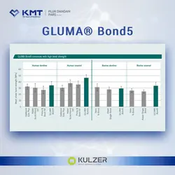 گلوما باند5 کولزر GLUMA® Bond5