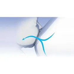 رابط سینه سیلیکونی چیکو Chicco - فروشگاه سیسمونی روژان