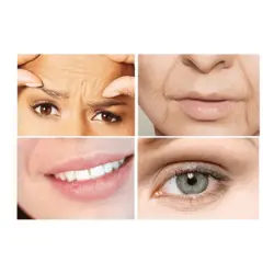 نخ کلاژن ساز جذبی بدون تزریق کره ای EELHOE - سوپریم کالا