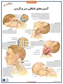 پوستر آسیب‌های شلاقی سر و گردن