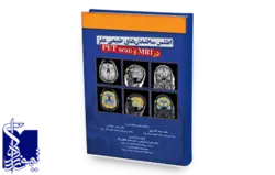 ‏‫اطلس ساختمان‌های طبیعی مغز در MRI و PET scan‬