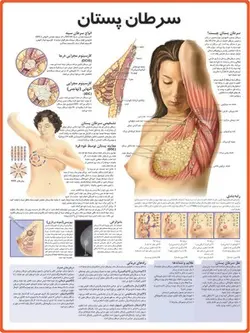 پوستر سرطان پستان