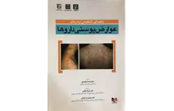راهنمای تشخیص و درمان عوارض پوستی دارو ها