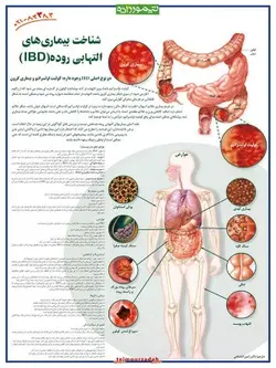 پوستر شناخت بیماری‌های التهابی روده (IBD)
