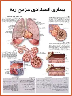 پوستر بیماری انسدادی مزمن ریه