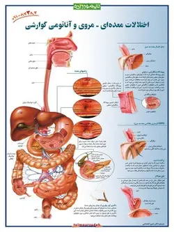پوستر اختلالات معده ای – مروی و آناتومی گوارشی