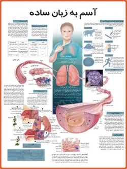 پوستر آسم به زبان ساده