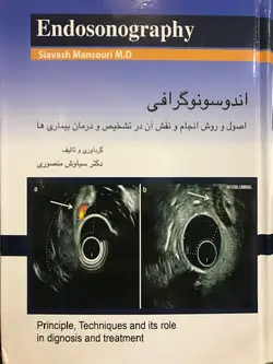 اندوسونوگرافی Endosonography - اصول و روش انجام نقش آن در تشخیص و درمان بیماری ها