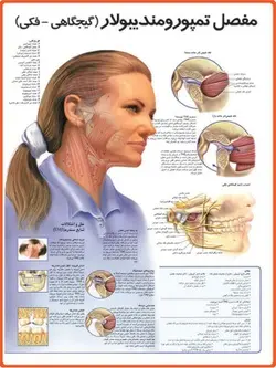 پوستر مفصل تمپورومندیبولار (گیجگاهی-فکی)