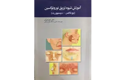 آموزش شیوه تزریق نوروتوکسین (بوتاکس - دیسپورت)