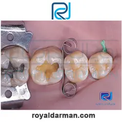 محافظ دندان Ultradent Interguard - رویال درمان
