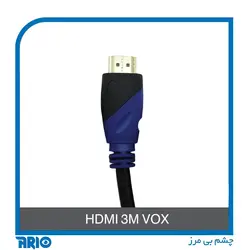 کابل HDMI طول 3 متر وکس - آریو