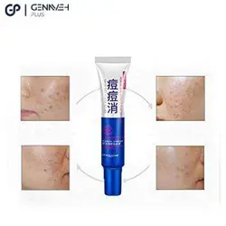 کرم درمانی ضد جوش بیوآکوا - از بین برنده جوش - فروشگاه آنلاین گناوه پلاس