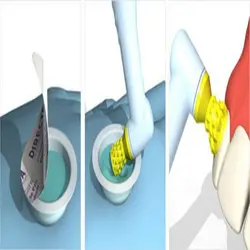 خمیر پروفیلاکسی