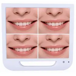 دوربین داخل دهانی با مانیتور FTZ