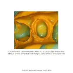 مواد قالب گیری VPS