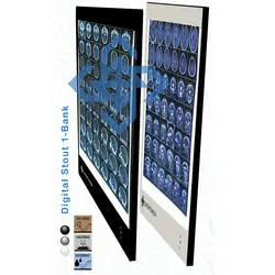 نگاتوسکوپ تک خانه لایت مد