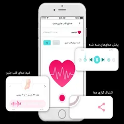 دستگاه شنود و ضبط صدای قلب جنین جامپر مدل JPD-100S9