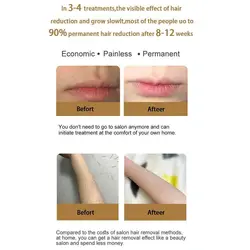 دستگاه لیزر خانگی IPL ICE Hair Removal Laser Painless