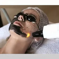 ژل کربن تراپی و جوانسازی پوست صورت تایگیت