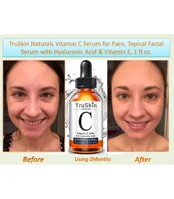 سرم ویتامین سی ترواسکین TruSkin Vitamin C