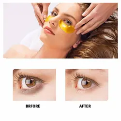 پچ زیر چشم خاویار طلایی بیوآکوا