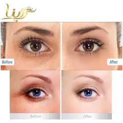 کرم دور چشم گلد کلاژن بالانس - فروشگاه اینترنتی لوازم آرایشی 💋 و بهداشتی ❤️ رژینا