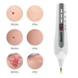 دستگاه پلاسما پن زیکن برقی بیکو حذف خال و تتو BEAUCO PLASMA