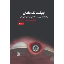 ایمپلنت تک دندان ۲۰۲۰ [ شایان نمودار ]