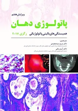 پاتولــوژی دهـان ( رگــزی ۲۰۱۷ ) [ رویان پژوه ]