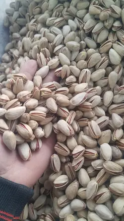 پسته اکبری اجیلی - دکتر پاین