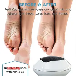 سنگ پا برقی Find Black