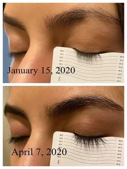 سرم تقویت کننده مژه و ابرو اوردینری مولتی پپتید لش اند برو - فروشگاه رادوکالا