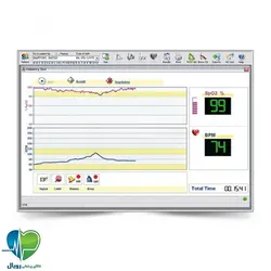 اسپیرومتر میر Spirolab