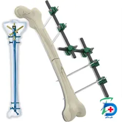 پیچ کورتیکال چهارونیم - Cortical Screw4.5 - طب دائم - TebDaem
