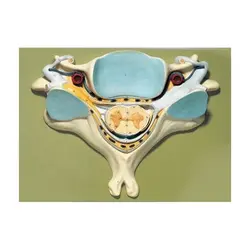 مولاژ نخاع ومهره گردن تابلو - طب دائم - TebDaem