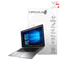 لپ تاپ استوک HP Elitebook 755 G3-AMD-AMD Graphic