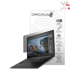 لپ تاپ استوک HP Zbook 14u G4-i7-FirePro W4190M