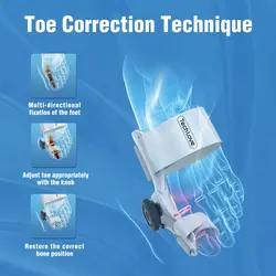 آتل اصلاح کننده بونیون شیائومی مدل Xiaomi Tech Love Bunion Corrector TJ608