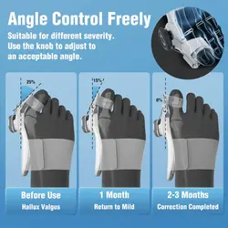 آتل اصلاح کننده بونیون شیائومی مدل Xiaomi Tech Love Bunion Corrector TJ608