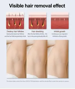 لیزر شارژری مناسب بانوان مدل Lescolton LS-T121 Sapphire Ice Hair Removal Device