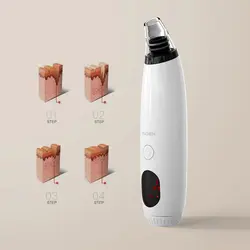 دستگاه مکنده جوش‌ سرسیاه ENCHEN مدل EB1001 شیائومی