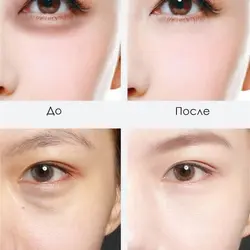 پچ زیر چشم عصاره خاویار زوسون